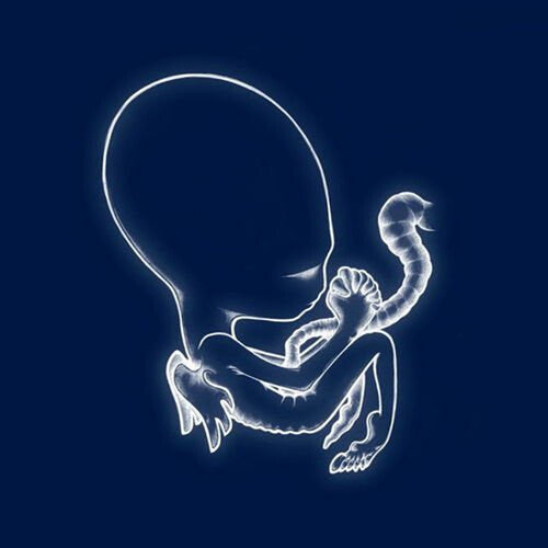 Sigur Ros: Agaetis Byrjun ( Vinyl )